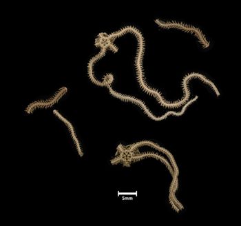 Media type: image;   Invertebrate Zoology OPH-3163 Description: Bottom of 2 brittle stars with a view of the discs.;  Aspect: ventral